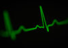 Symbolbild: EKG Ausschlag