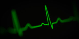 Symbolbild: EKG Ausschlag