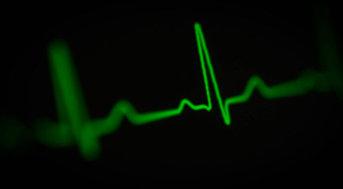 Symbolbild: EKG Ausschlag