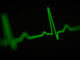 Symbolbild: EKG Ausschlag